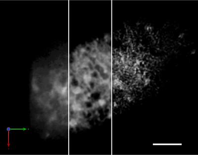 Super resolution live imaging: The key for unveiling the true dynamics of membrane traffic around the Golgi apparatus in plant cells